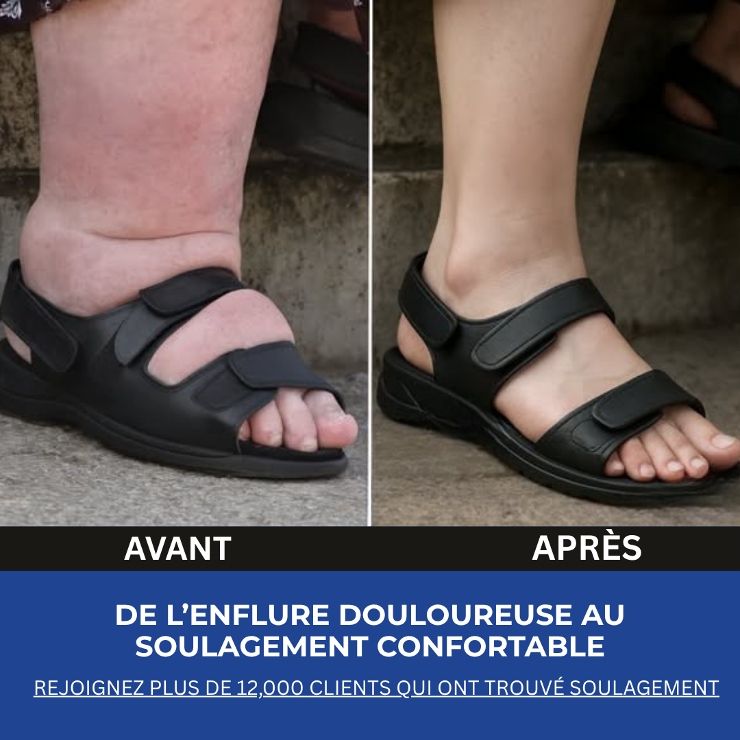 Crème Apaisante Oasis™ Soulagement Rapide des Douleurs Neuropathiques et Engourdissements